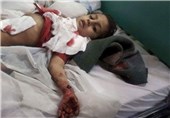 شهادت 4021 یمنی از جمله 576 کودک از آغاز تجاوز عربستان به یمن