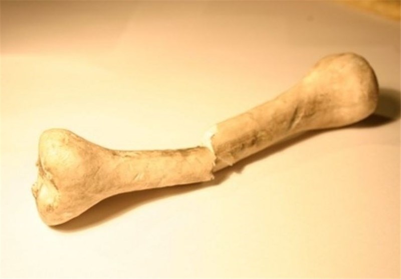 ساعتی 6 استخوان لگن در ایران می‌شکند/ پوکی استخوان 80 درصد زنان بالای 50 سال