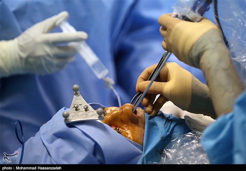 عمل جراحی برداشتن تومور مغزی از طریق بینی با ناوبری ساخت ایران
