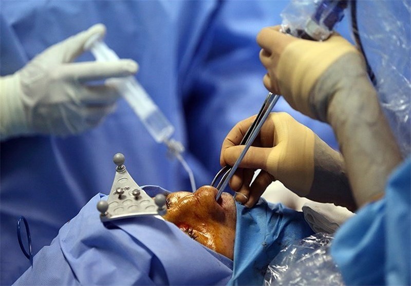 درآمد 50 میلیونی برای یک عمل جراحی دیگر نیست