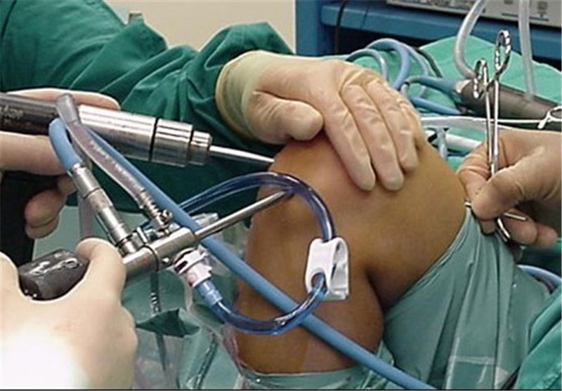 افشای نوعی تخلف جراحی زانو در کشور
