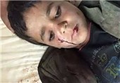 عفو بین‌الملل: عربستان با بمب‌های آمریکایی به کشتار ملت یمن دست می‌زند