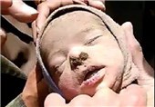 شهادت نوزاد 12روزه یمنی در حملات عربستان + تصاویر