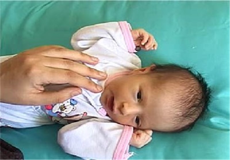 فیلم/ تولد نخستین نوزاد به روش &quot;تایم لاپس&quot; در ایران