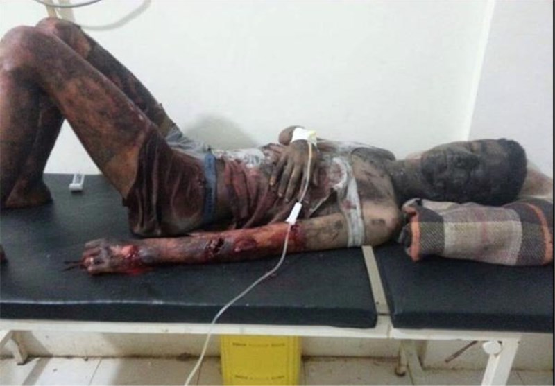 105 شهید در جنایت جدید عربستان در حمله به تعز + تصاویر