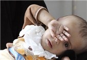 تصاویر گرسنگی در یمن