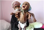 پزشکان بدون مرز: ادامه محاصره یمن شهروندان بیشتری را «می‌کشد»