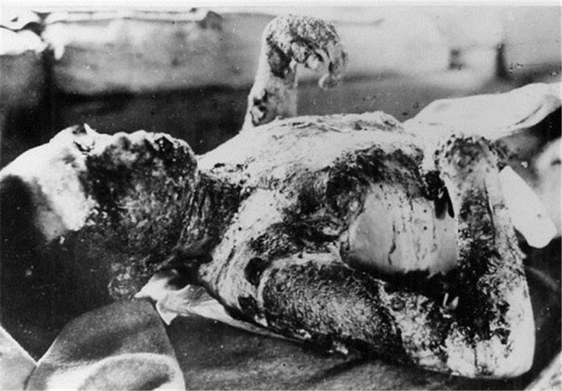 ‘Faceless Body Belonged to My Sister’: Hiroshima, Nagasaki Nuke Survivors Recall Horrors