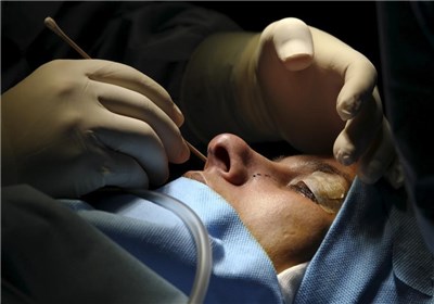  انجام عمل "جراحی بینی" توسط کدام جراحان مجاز است؟ 