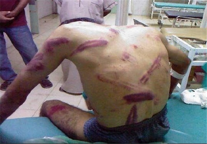 اوضاع بد زندانیان بحرینی و شیوع بیماری‌های واگیردار