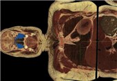 دقیق‌ترین تصویر دیجیتالی از بدن با جسدی که 5000 تکه شد