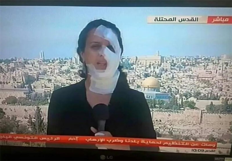 خبرنگار المیادین پس از زخمی شدن به روی آنتن رفت+عکس