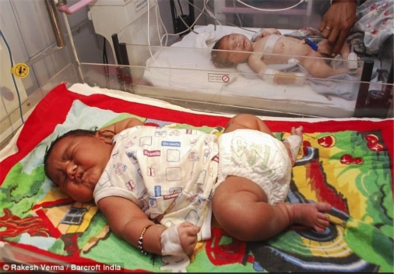 تولد نوزاد 6 کیلوگرمی در هند + تصاویر