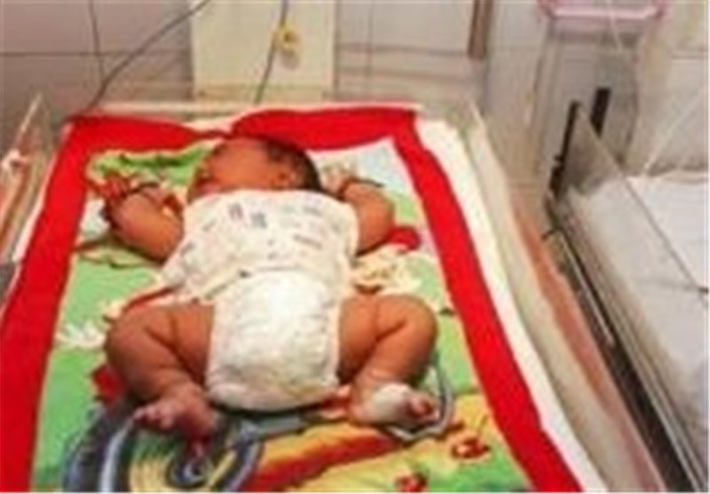 تولد نوزاد 5.8 کیلوگرمی در هند + عکس