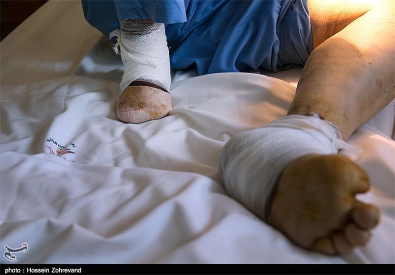 پانسمان بیـــــــــــــــــــــمه نیست