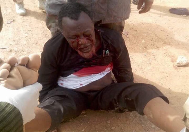 Nigerian Cleric Sheikh Zakzaky Survived 4 Shots: IMN Spokesman