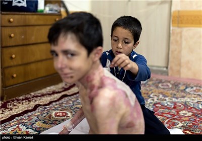 برادر کوچک هادی در حال تعویض باند و ضدعفونی کردن زخم های او است .