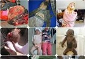 8 هزار شهید و 28 هزار زخمی از آغاز تجاوز سعودی به یمن