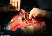 نخستین عمل جراحی قلب در کهگیلویه و بویراحمد انجام شد
