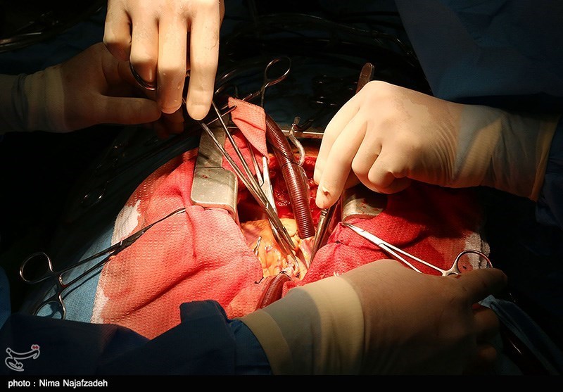 &quot;جراحی قلب باز بدون متوقف‌کردن قلب&quot; برای نخستین بار در کشور