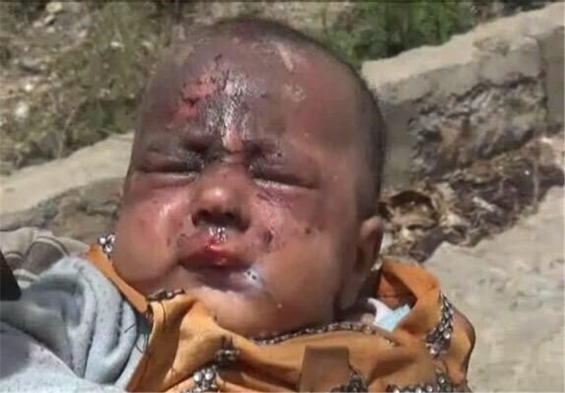 آخرین آمار جنایت سعودی‌ها در یمن/ 10 هزار شهید و 18 هزار زخمی