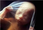 دلایل سفت‌شدن جنین در بارداری