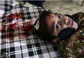 تصاویر/کودکان سوری‎ قربانیان جنگ