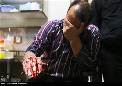 مصدومان شب چهارشنبه آخر سال - بیمارستان 15 خرداد