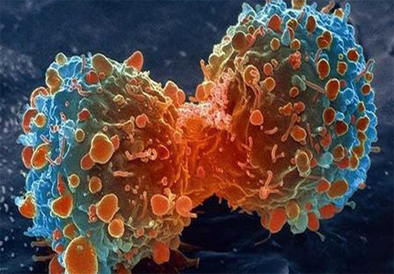 تشخیص سرطان لوزالمعده از طریق باکتری‌های دهان
