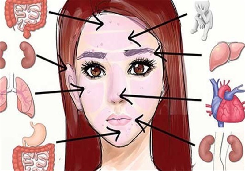 محل جوش‌ها بیماریتان را فاش می کنند