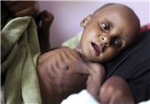تصاویر/گرسنگی در یمن‎