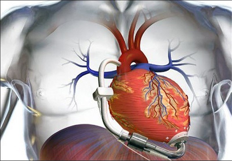 بازسازی لایه بیرونی قلب با استفاده از سلول‌های بنیادی