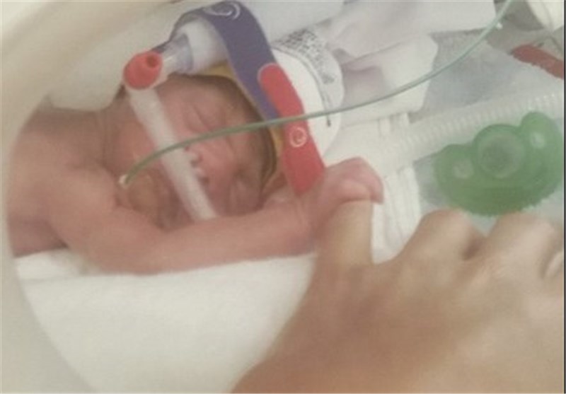 مشکل تنفسی نوزاد در بدو تولد
