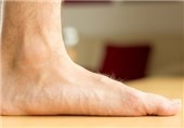 توصیه هایی برای افرادی که کف پای صافی دارند