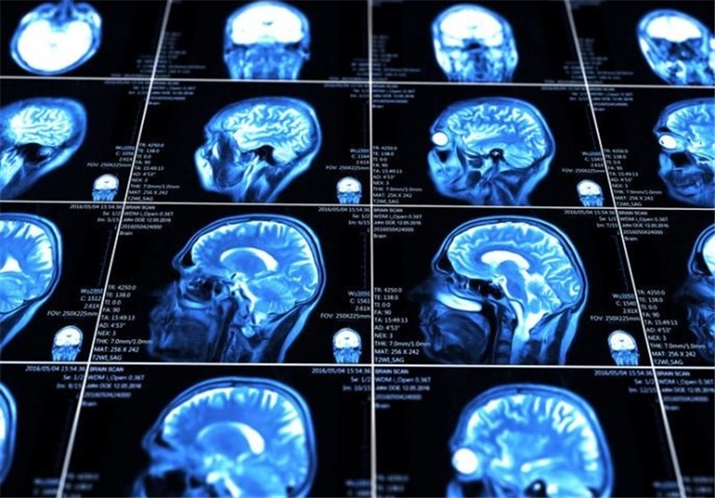 New Tech Could Deliver Drugs to Brain Injuries