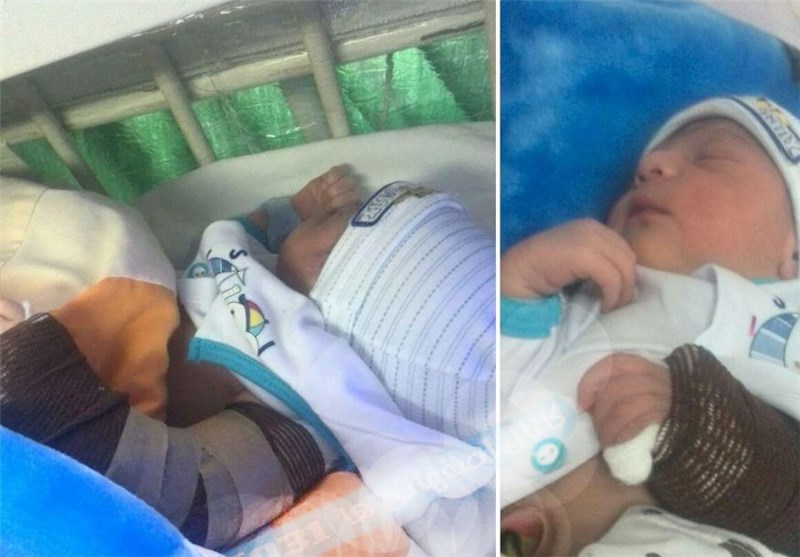 شکستگی بازوی نوزاد اصفهانی حین عمل زایمان صحت ندارد