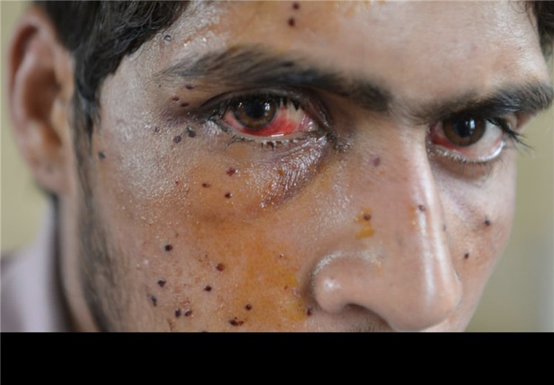 بھارتی تنظیم: کشمیریوں کی موجودہ حالت زار کی ذمہ دار دہلی حکومت