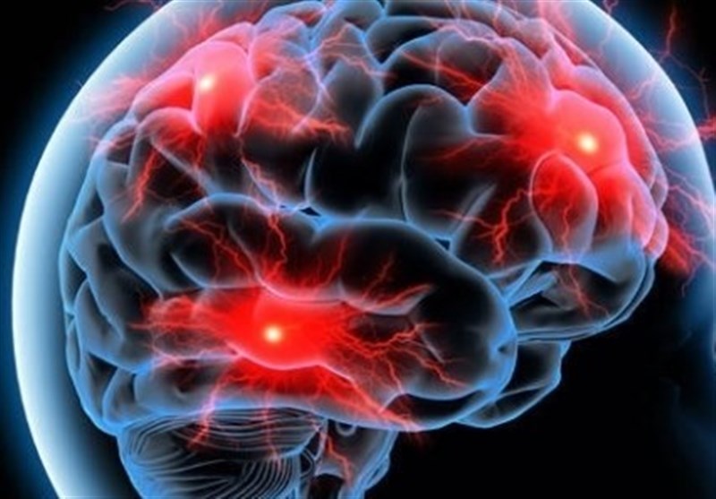 ارتباط ضربه مغزی و بروز آلزایمر