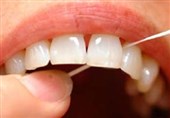 آشنایی با علایم حساسیت دندانی/ درد تیز و کوتاه دندان از این بیماری خبر می دهد