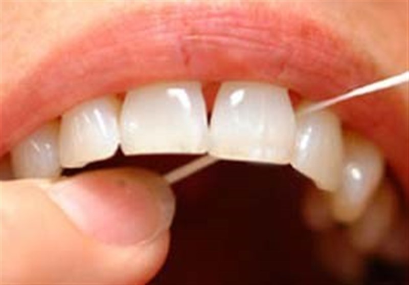 سفید کردن دندان به روش هالیوودی ها!