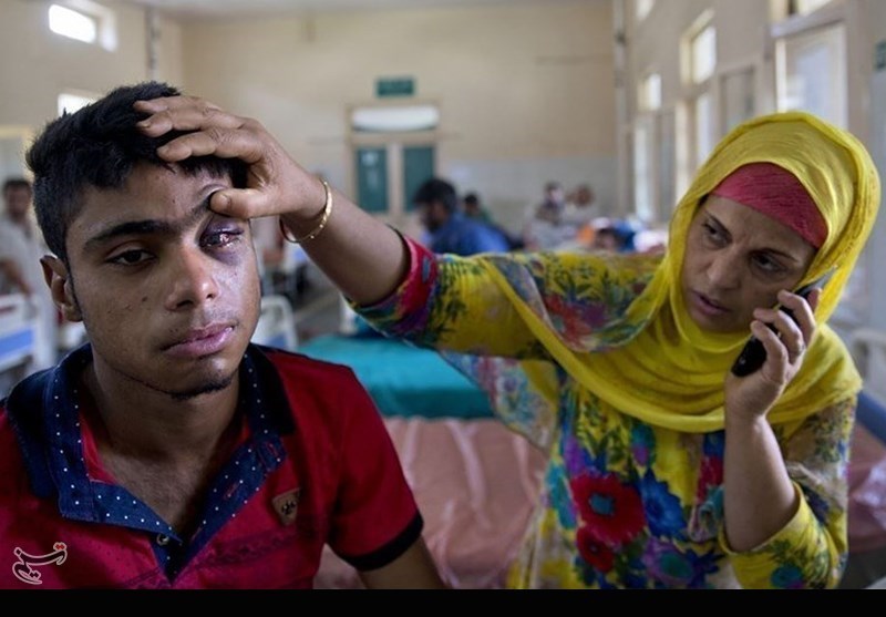 گلوله‌های ساچمه‌ای هدیه چشمان مردم کشمیر در روزهای عید + تصاویر
