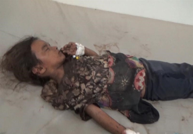 جنایت جدید عربستان در روستای الخواریه در حجه یمن + تصاویر