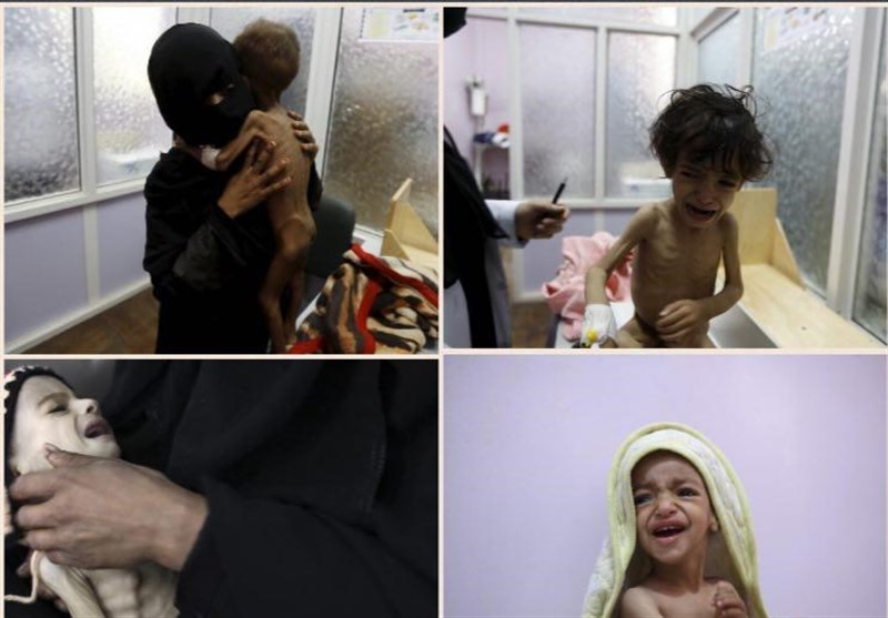 تصاویر‌ چهره‌های دردناک/جنگ با کودکان یمنی چه کرد؟