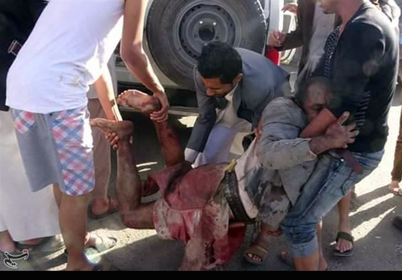 توقف صادرات سلاح به عربستان، تنها شانس غرب برای پایان کشتارها در یمن