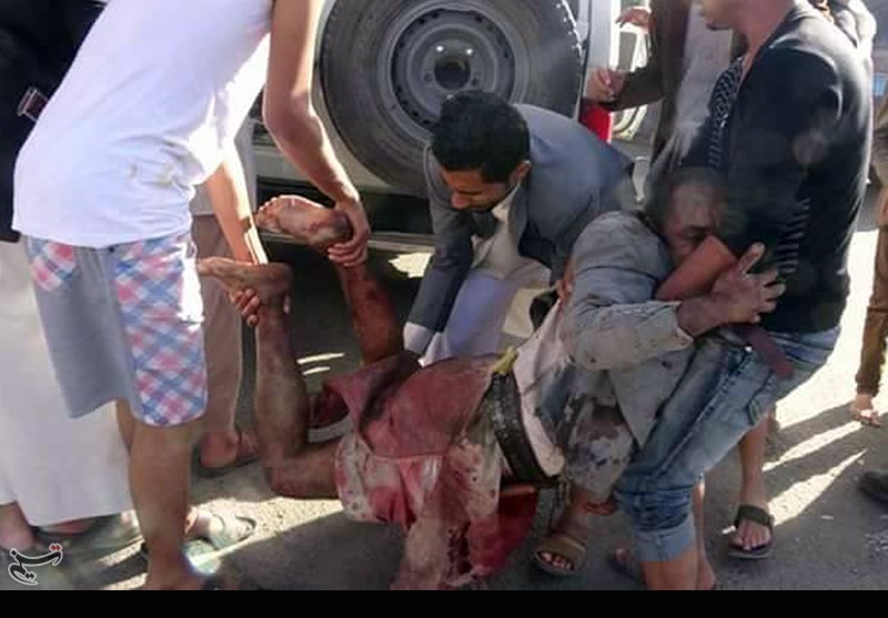 جدیدترین آمار شهدا و مجروحان تجاوز سعودی به روایت وزارت بهداشت یمن