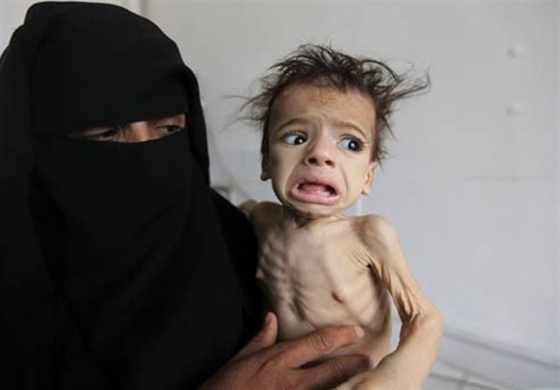 سعودی جارحیت سے یمنیوں کو خطرناک قحط کا سامنا ہے، انسانی حقوق