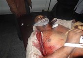 9 شهید و 8 زخمی در حملات عربستان به استان إب یمن +تصاویر