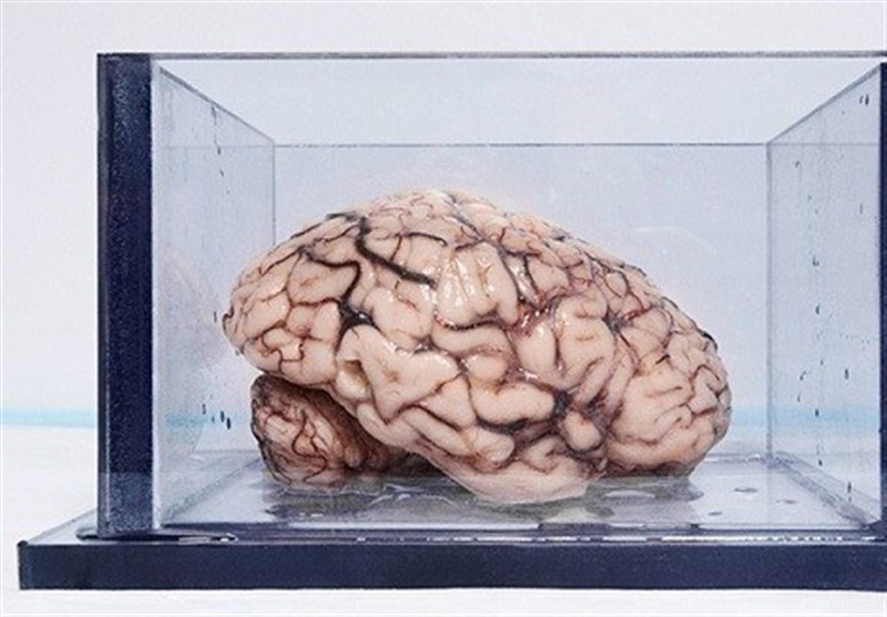 مشهورترین مغز جهان