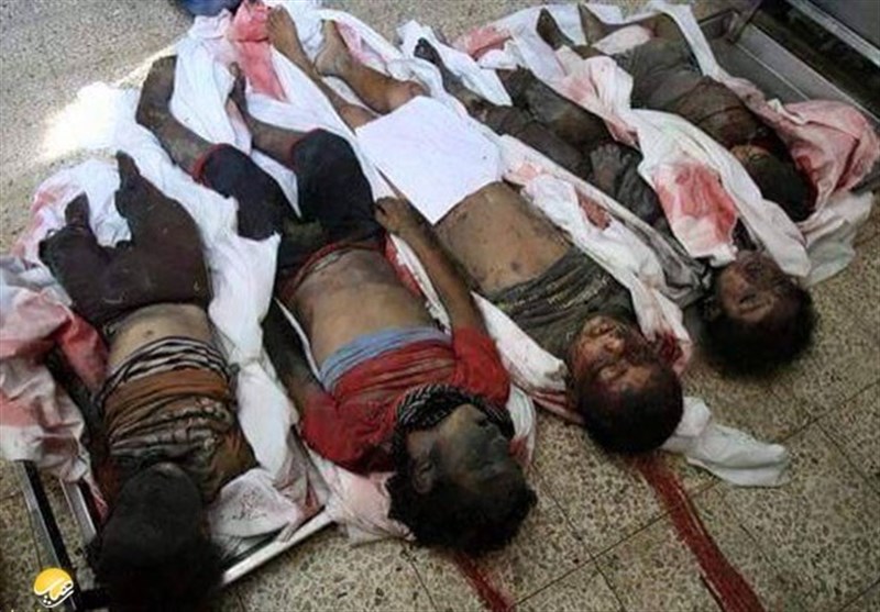تصاویری دلخراش از 2 سال جنایات عربستان علیه ملت یمن