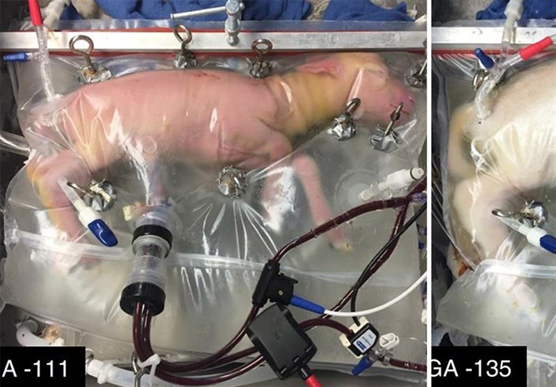 استقبال گسترده مخاطبان عرب‌زبان از پیشرفت علمی ایران در ساخت "رحم مصنوعی"